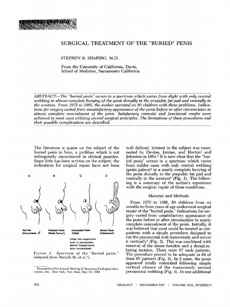 What Is a Buried Penis? - Causes, Treatments for Hidden Penis