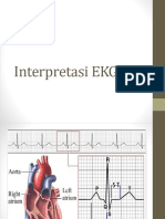 Interpretasi EKG-1