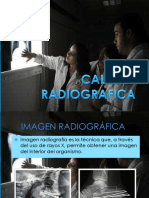 Factores que afectan la calidad radiográfica