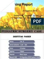 MR Small Bowel Obstruction Ec Invaginasi