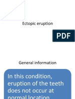 35ectopic Eruption