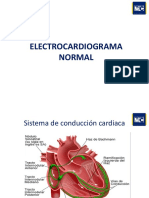 EKG Muestra