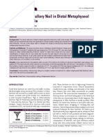 Intramedullary Nailing Effective for Distal Tibia Fractures