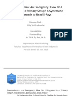 Pneumothorax: An Emergency! How Do I Diagnose in A Primary Setup? A Systematic Approach To Read X-Rays