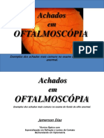 Achados em oftalmoscopia
