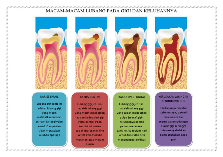 Jenis-jenis Karies Gigi dan Keluhannya | PDF | Seni & Disiplin Bahasa ...