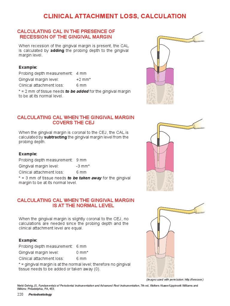 Calculating Clinical Attachment Loss | PDF | Science & Mathematics