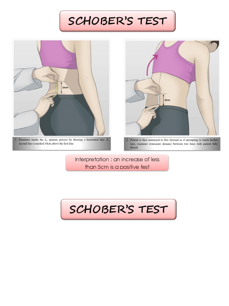 Schober's Test Procedure and Interpretation | PDF