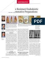Fracture Resistant Endodontic and Restorative Dentistry