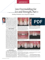 Injection Overmolding For Aesthetics and Strength Part 1