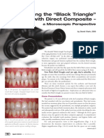 Treating Black Triangles With Direct Composite