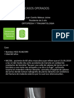 Caso Operadoc Plat