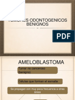 Tumores Odontogenicos benignos