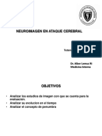 Accidente Cerebrovascular Isqúemico1111alber