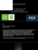 CASO OPERADOC ESC MTT.pptx