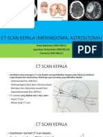 CT Scan Kepala (Meningioma, Astrositoma)