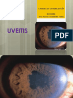 UVEITIS