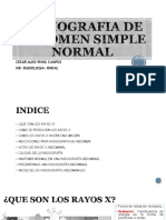 Radiografia de Abdomen Simple Normal