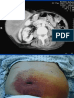 Hernias - Caballero (Parte 2)