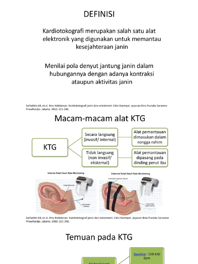 CTG | PDF