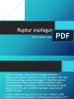 Ruptur-esofagus.pptx