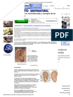 Definicion de La Auriculoterapia y Conceptos de Las Somatotopas