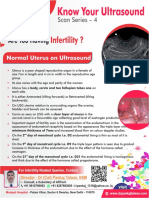 Normal Uterus On Ultrasound