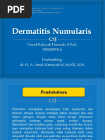 Lapsus Dermatitis Numularis