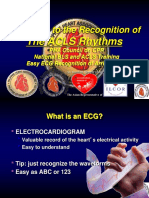 5 Arrhythmia Recognition