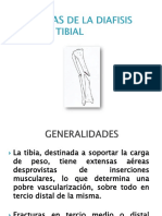 Fracturas de La Diafisis Tibial