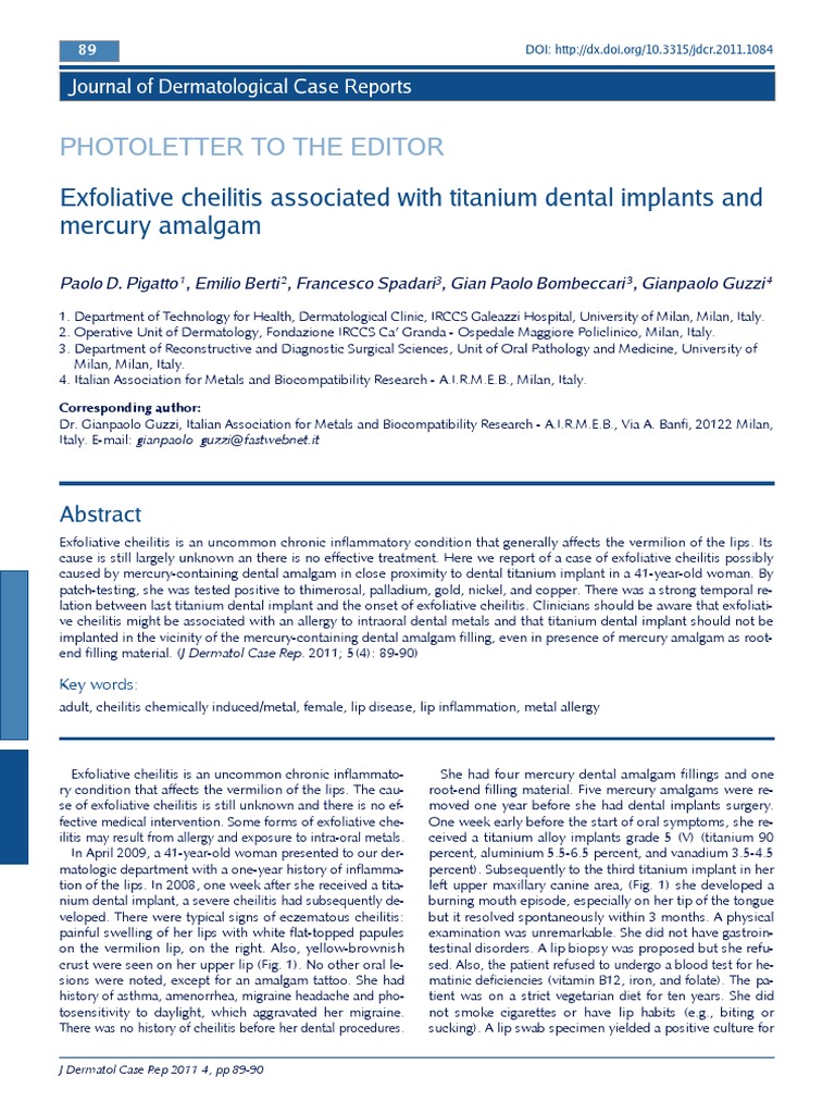 Exfoliative Cheilitis Associated With Titanium Dental Implants and