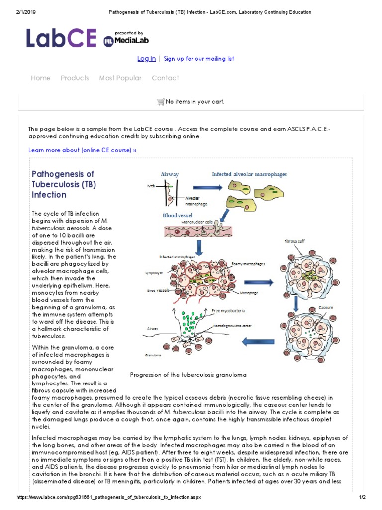 Pathogenesis of Tuberculosis (TB) Infection LabCE Com, Laboratory