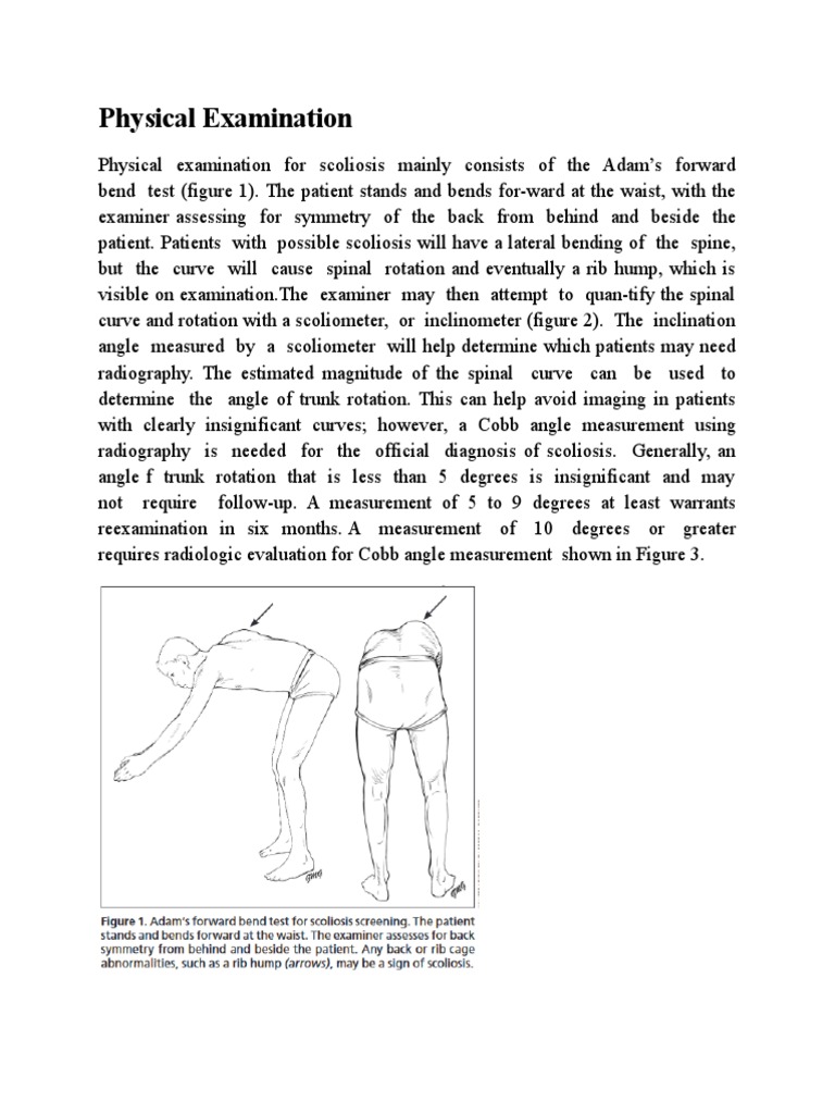 Physical Examination Scoliosis PDF Scoliosis Clinical Medicine