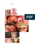 DSTs bacterianas: sinais e sintomas