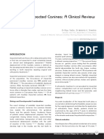 Maxillary Impacted Canines: A Clinical Review: DR Rajiv Yadav, DR Basanta K. Shrestha