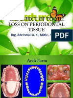 The Effect of Tooth Loss On Periodontal Tissue