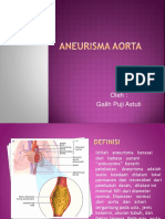 Aneurisma Aorta