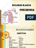 Pneumonia