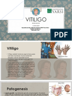 Vitiligo