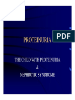 The Child with Proteinuria & Nephrotic Syndrome