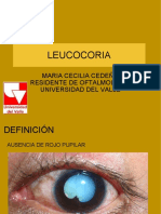 Leucocoria: Maria Cecilia Cedeño Residente de Oftalmologia Universidad Del Valle