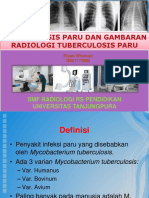 DT Gambaran Radiologi TB Paru