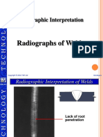 Radiographic Interpretation: Radiographs of Welds
