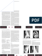 RM DE LOS TUMORES ÓSEOS.pdf