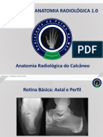 Anatomia Radiológica - Calcâneo, RPM