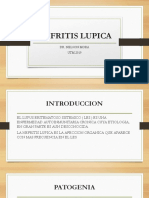 Nefritis Lupica