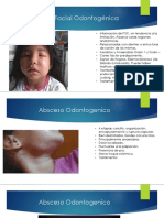 Celulitis Facial Odontogénica.pptx