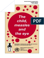 Child Measles Eye Eng 300