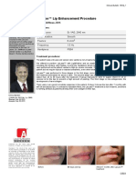 Liplase™ Lip Enhancement Procedure