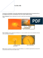 Desarrollo Del Pollo